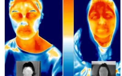 Medical Thermography As A Non-Invasive And Contactless Screening Tool For COVID-19 Patients